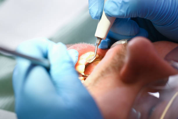 Best Cracked Tooth Emergency Dentist  in Crompond, NY