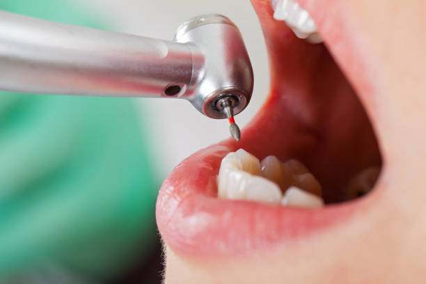 Best Dentist for Tooth Abscess  in Crompond, NY